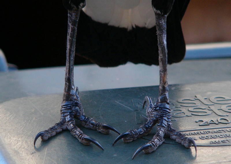 Pigeon Toes; DISPLAY FULL IMAGE.