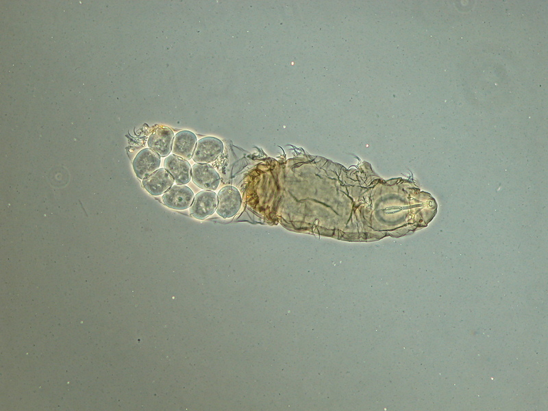 Tardigrade / Water Bear (Dactylobiotus parthenogeneticus); DISPLAY FULL IMAGE.