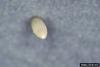 Cabbage White Butterfly (Pieris rapae) egg