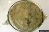 Soybean Cyst Nematode (Heterodera glycines)