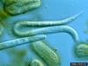 Yellow potato cyst nematode (Globodera rostochiensis)