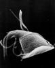 Giardia (parasite) Scanning EM GIF