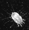 Dust mite picture