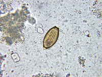 Trichuris trichiura - Whipworm