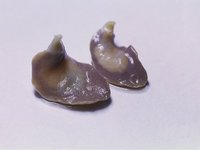 Fasciola hepatica