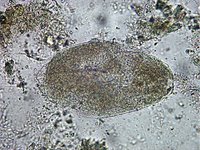 Fasciola hepatica