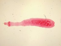 Echinococcus granulosus