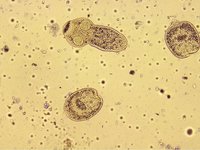 Echinococcus granulosus