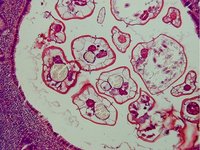 Enterobius vermicularis