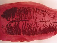 Taenia saginata