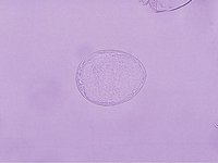 Schistosoma japonicum