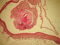 Taenia solium