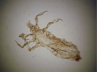 Pediculus humanus - Body Louse