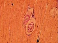 Trichinella spiralis