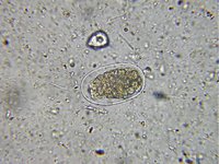 Ancylostoma duodenale
