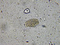 Ancylostoma duodenale