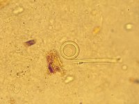 Taeniidae