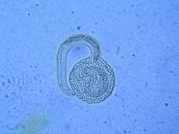 Toxocara canis