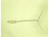 Schistosoma