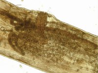 Enterobius vermicularis