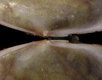 Gari intermedia