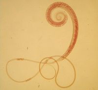 Trichuris trichiura - Whipworm