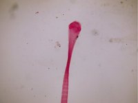 Dipylidium caninum