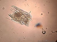 Polyarthra vulgaris