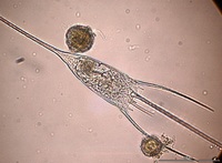 Kellicottia longispina