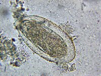 Schistosoma mansoni