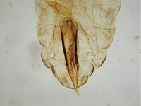Pediculus humanus - Body Louse