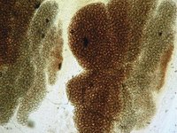 Diphyllobothrium latum