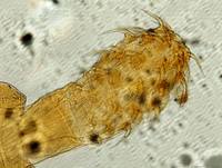 Acanthocephalus anguillae