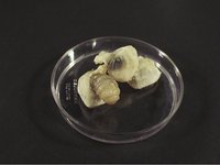 Dermatobia hominis - Human bot fly