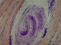 Trichinella spiralis