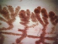 Taenia solium