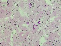 Wuchereria bancrofti
