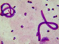 Wuchereria bancrofti