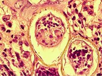 Schistosoma mansoni