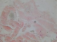 Echinococcus granulosus