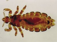 Pediculus humanus capitis