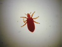 Pediculus humanus - Body Louse