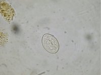 Diphyllobothrium latum