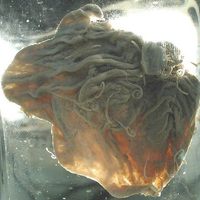 Trichuris trichiura - Whipworm