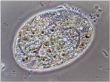 climacostomum virens (protozoon)