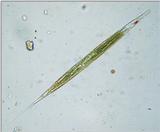 Protozoon: euglena acus