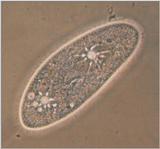 More Protozoa - The Secrets Of Paramecium Caudatum - KLEIN's silver lines