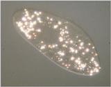 Protozoa - Paramecium caudatum part two - polarized light