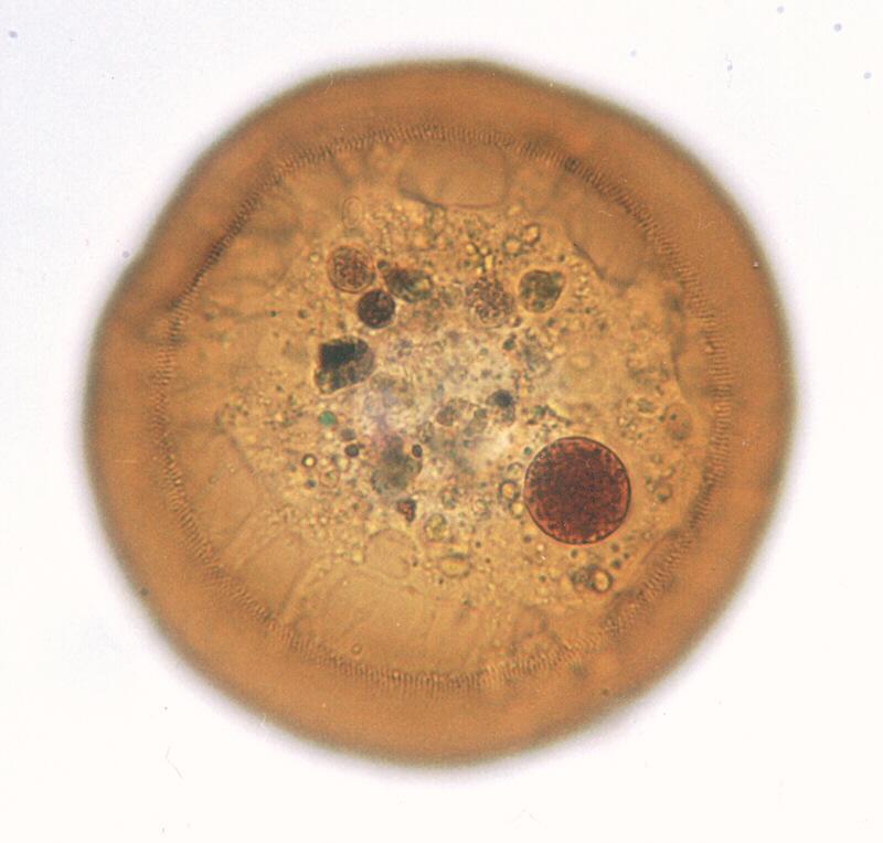 Protozoa - Amoebae - Arcella once more; DISPLAY FULL IMAGE.