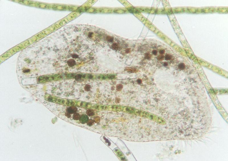 Protozoa - more ciliates - Euplotes; DISPLAY FULL IMAGE.
